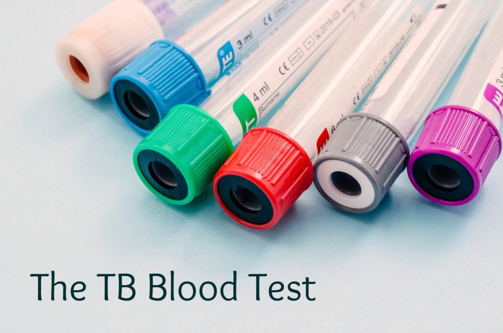 Science is Awesome Introducing the TB Blood Test